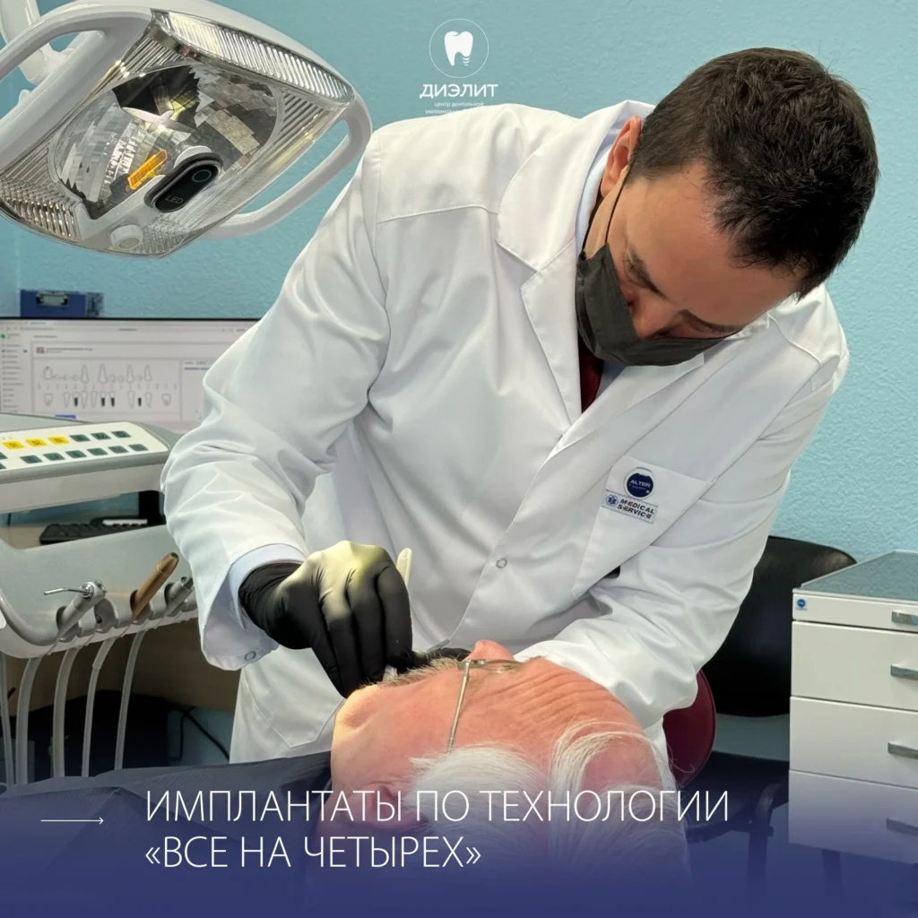 Имплантация верхней и нижней челюсти